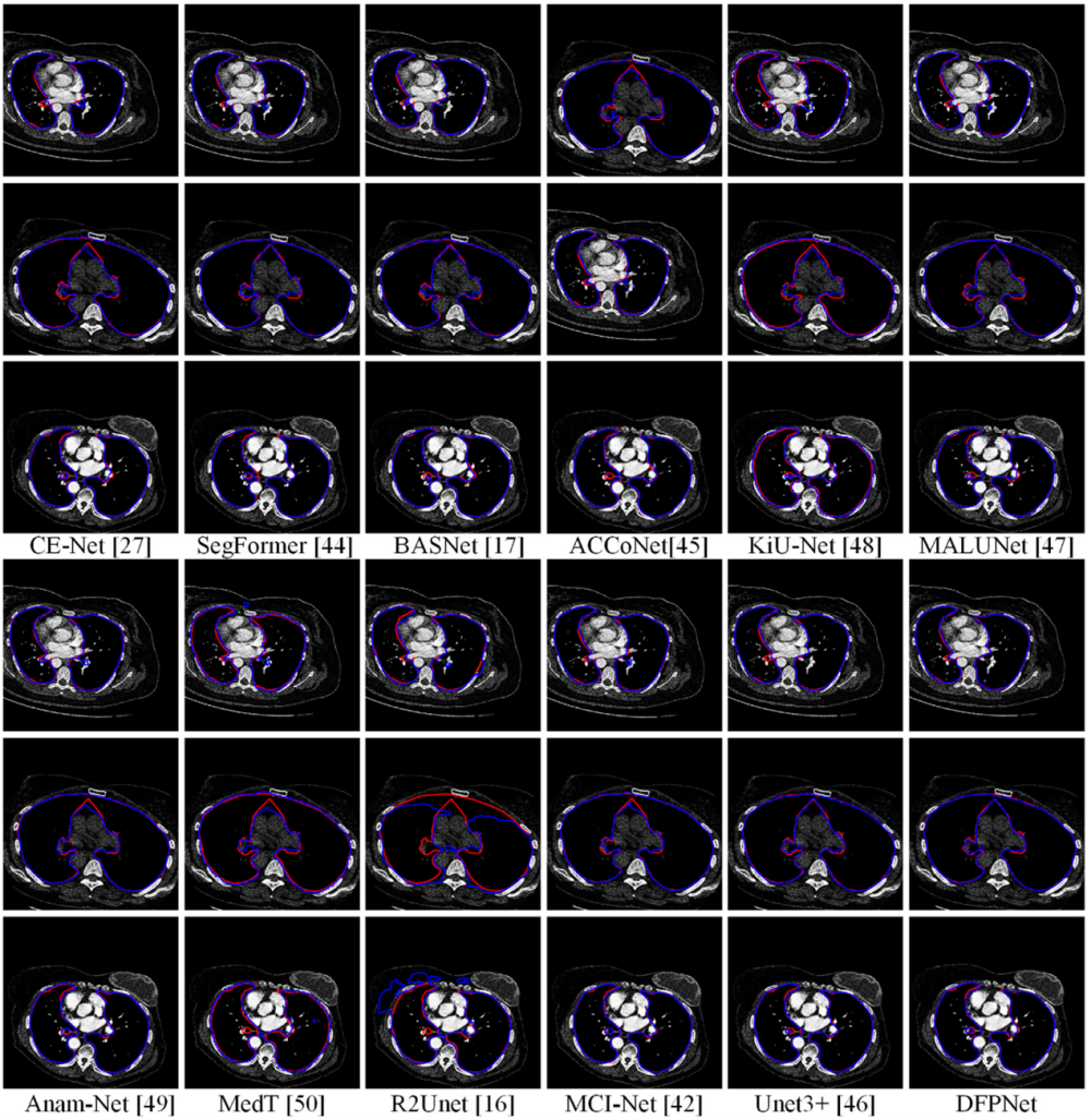 医学病理图像分析示例2